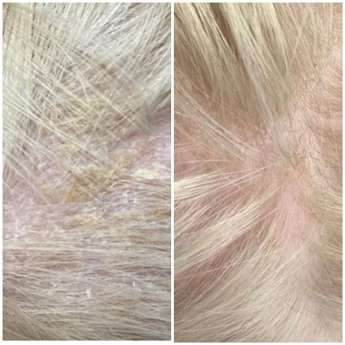 DETSKÁ SEBOREA